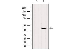 Image no. 2 for anti-CXXC Finger Protein 5 (CXXC5) antibody (ABIN6261130)