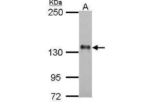WB Image Sample (30 ug of whole cell lysate) A: H1299 5% SDS PAGE antibody diluted at 1:500