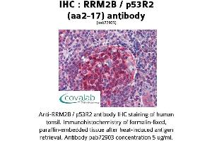 Image no. 1 for anti-Ribonucleotide Reductase M2 B (TP53 Inducible) (RRM2B) (AA 2-17) antibody (ABIN1738967)