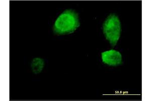 Image no. 1 for anti-Inhibitor of Growth Family, Member 3 (ING3) (AA 1-92) antibody (ABIN565750)