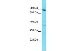 Western Blotting (WB) image for anti-G Protein-Coupled Receptor 141 (GPR141) (Middle Region) antibody (ABIN2791031)