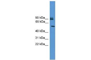 Image no. 1 for anti-Oxysterol Binding Protein-Like 11 (OSBPL11) (C-Term) antibody (ABIN2782307)
