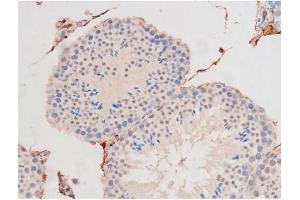 Image no. 11 for anti-Mast/stem Cell Growth Factor Receptor (KIT) (pTyr703) antibody (ABIN6255994)
