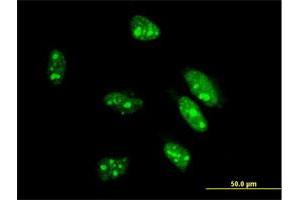 Image no. 4 for anti-Caudal Type Homeobox 1 (CDX1) (AA 126-215) antibody (ABIN514322)