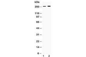 Image no. 2 for anti-Periplakin (PPL) (AA 1664-1701) antibody (ABIN5647242)