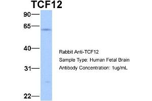 Image no. 2 for anti-Transcription Factor 12 (TCF12) (N-Term) antibody (ABIN2774659)