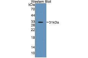 Image no. 2 for anti-ATP-Binding Cassette, Sub-Family B (MDR/TAP), Member 8 (ABCB8) (AA 468-717) antibody (ABIN5013188)