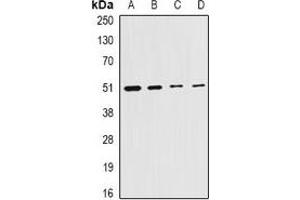 Image no. 1 for anti-Citrate Synthase (CS) antibody (ABIN2966527)