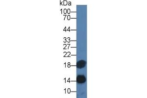 Mouse Capture antibody from the kit in WB with Positive Control: Sample Human Serum.