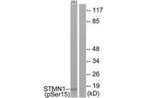 Image no. 1 for anti-Stathmin 1 (STMN1) (AA 5-54), (pSer16) antibody (ABIN1531981)