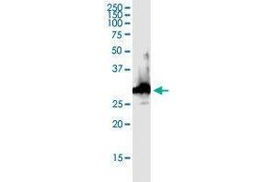 Western Blotting (WB) image for CACYBP (Human) IP-WB Antibody Pair (ABIN1989470)