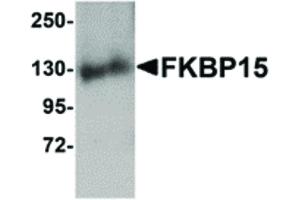 Image no. 1 for anti-FK506 Binding Protein 15, 133kDa (FKBP15) (N-Term) antibody (ABIN6656193)