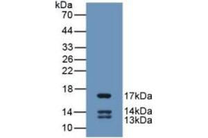 Image no. 1 for Urocortin 2 (UCN2) ELISA Kit (ABIN6574307)