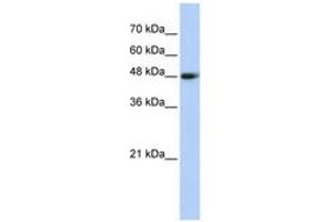 Image no. 1 for anti-Carboxypeptidase N Subunit 1 (CPN1) (AA 323-372) antibody (ABIN6743604)