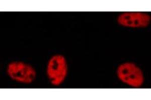 Image no. 1 for anti-Bromodomain Containing 3 (BRD3) (C-Term) antibody (ABIN6260308)