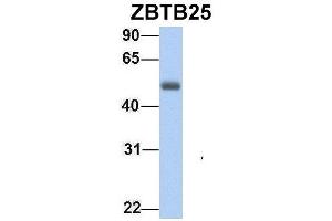 Image no. 4 for anti-Zinc Finger and BTB Domain Containing 25 (ZBTB25) (Middle Region) antibody (ABIN2780821)
