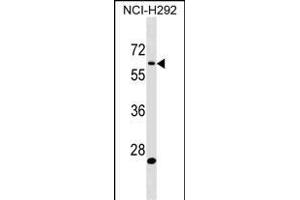 BA3 Antibody (Center) 18975c western blot analysis in NCI- cell line lysates (35 μg/lane).