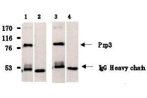 Image no. 3 for anti-PRP3 Pre-mRNA Processing Factor 3 Homolog (PRPF3) antibody (ABIN1449201)