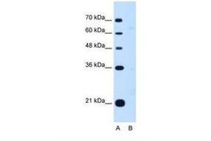 Image no. 1 for anti-Downstream Neighbor of SON (DONSON) (AA 301-350) antibody (ABIN6738192)