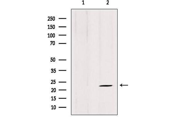 anti-ADP-Ribosylation Factor-Like 8B (ARL8B) (Internal Region) antibody