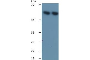 Rabbit Detection antibody from the kit in WB with Positive Control: Sample Lane1: Human A549 Cells; Lane2: Human MCF-7 Cells.