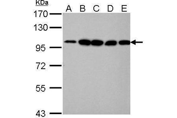 alpha Actinin 4 antibody  (C-Term)