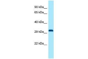 Image no. 1 for anti-Distal-Less Homeobox Protein 1 (DLX1) (C-Term) antibody (ABIN2778573)