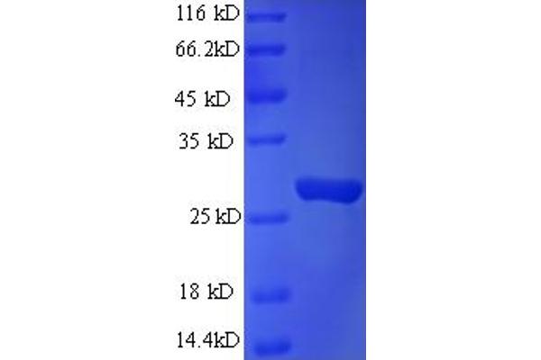 RAB3A Interacting Protein (Rabin3)-Like 1 (RAB3IL1) (AA 21-247) protein (His tag)