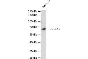 UGT1A1 Antikörper  (AA 1-200)
