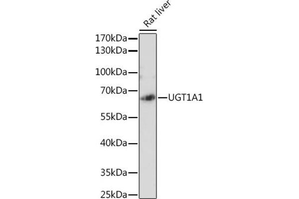 UGT1A1 Antikörper  (AA 1-200)