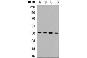 Image no. 2 for anti-Protein Kinase, AMP-Activated, beta 1 Non-Catalytic Subunit (PRKAB1) (Center) antibody (ABIN2972751)