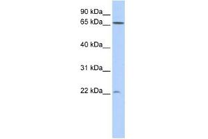 Image no. 1 for anti-DIRAS Family, GTP-Binding RAS-Like 1 (DIRAS1) (N-Term) antibody (ABIN634394)