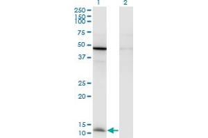 Image no. 3 for anti-Chemokine (C-C Motif) Ligand 2 (CCL2) (AA 1-99) antibody (ABIN948442)