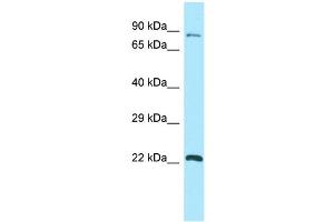 Image no. 1 for anti-G-Protein Signaling Modulator 1 (GPSM1) (C-Term) antibody (ABIN2790186)