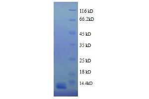 SDS-PAGE (SDS) image for Hemoglobin (full length) protein (ABIN1045101)