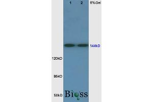 Image no. 4 for anti-Fms-Related tyrosine Kinase 1 (VEGFR1) (FLT1) (AA 1162-1260) antibody (ABIN725795)