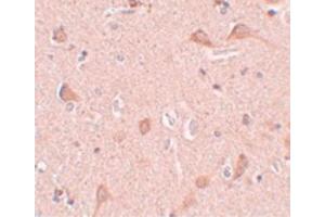 Image no. 3 for anti-Signal-Induced Proliferation-Associated 1 Like 1 (SIPA1L1) (N-Term) antibody (ABIN6657196)