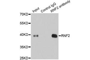 Image no. 8 for anti-Ring Finger Protein 2 (RNF2) antibody (ABIN6147029)