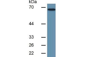 Image no. 5 for Lipopolysaccharide Binding Protein (LBP) ELISA Kit (ABIN6574276)