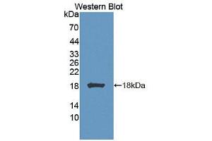 Image no. 2 for anti-Biliverdin Reductase A (BLVRA) (AA 1-125) antibody (ABIN1866905)