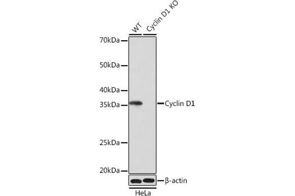 Cyclin D1 抗体