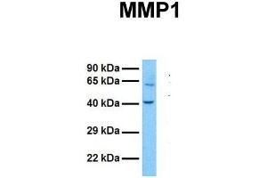 Image no. 6 for anti-Matrix Metallopeptidase 1 (Interstitial Collagenase) (MMP1) (N-Term) antibody (ABIN2777119)
