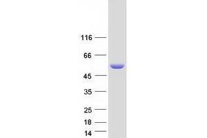 Image no. 1 for S-Antigen, Retina and Pineal Gland (Arrestin) (SAG) protein (Myc-DYKDDDDK Tag) (ABIN2731282)