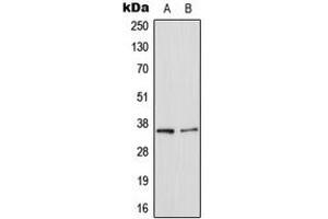 Image no. 3 for anti-Lectin, Galactoside-Binding, Soluble, 8 (LGALS8) (Center) antibody (ABIN2706203)