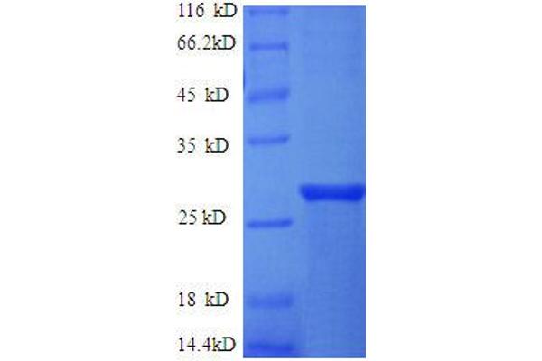 ERAS Protein (AA 3-230, partial) (His tag)