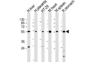 Image no. 3 for anti-Serotonin Receptor 2B (HTR2B) (AA 408-435), (C-Term) antibody (ABIN655076)