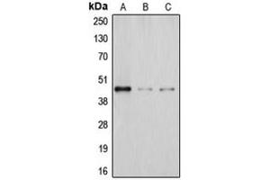 Image no. 1 for anti-Deoxyhypusine Synthase (DHPS) (Center) antibody (ABIN2706035)