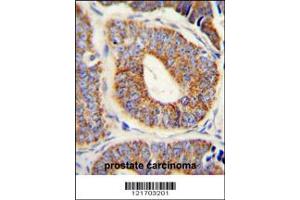 Immunohistochemistry (IHC) image for anti-DnaJ (Hsp40) Homolog, Subfamily A, Member 1 (DNAJA1) antibody (ABIN2158571)