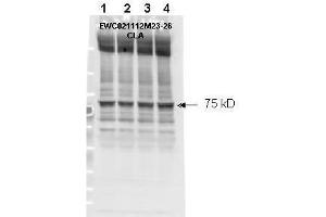 Image no. 1 for anti-Neurofibromin 2 (NF2) (pSer518) antibody (ABIN104130)