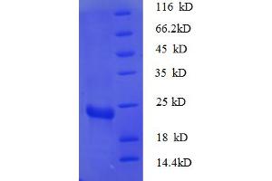 RPS7 Protein (AA 2-179) (His tag)